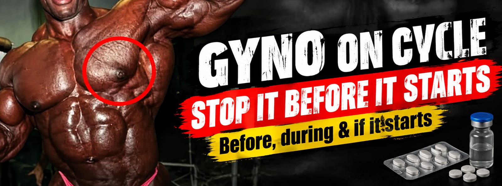 How to Prevent Gyno on Cycle (Before, During, and Emergency)